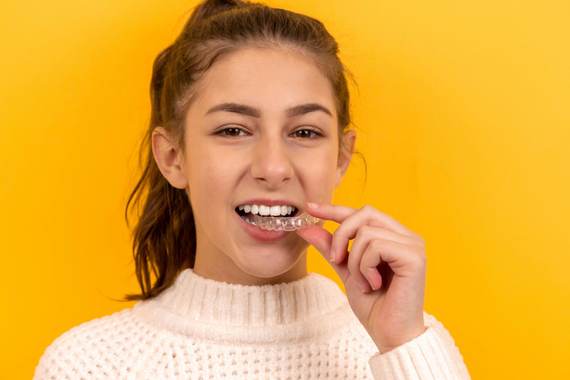 Clear Aligners
